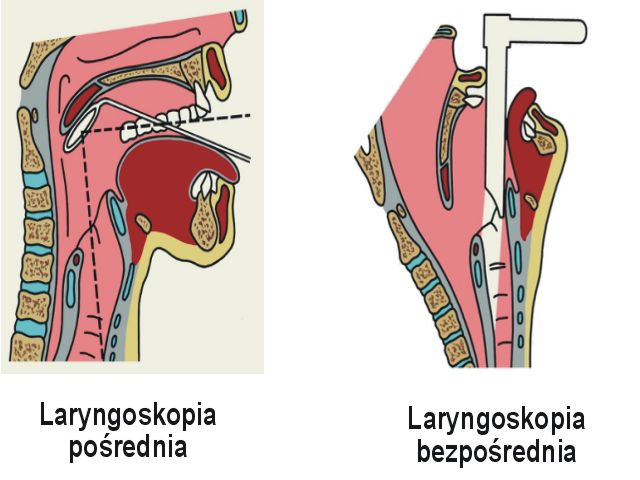Laryngoskopia